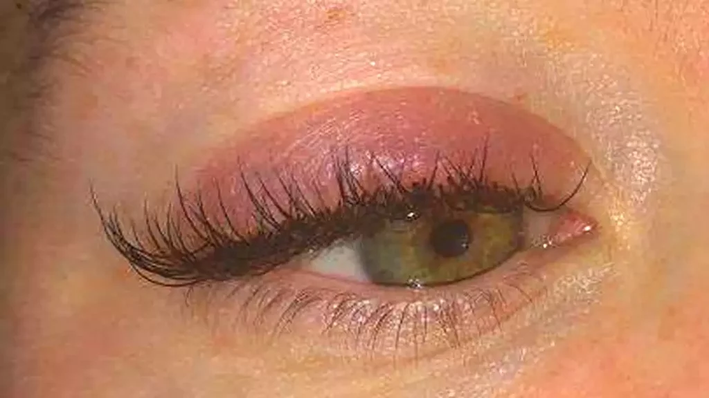 allergy to lash extensions