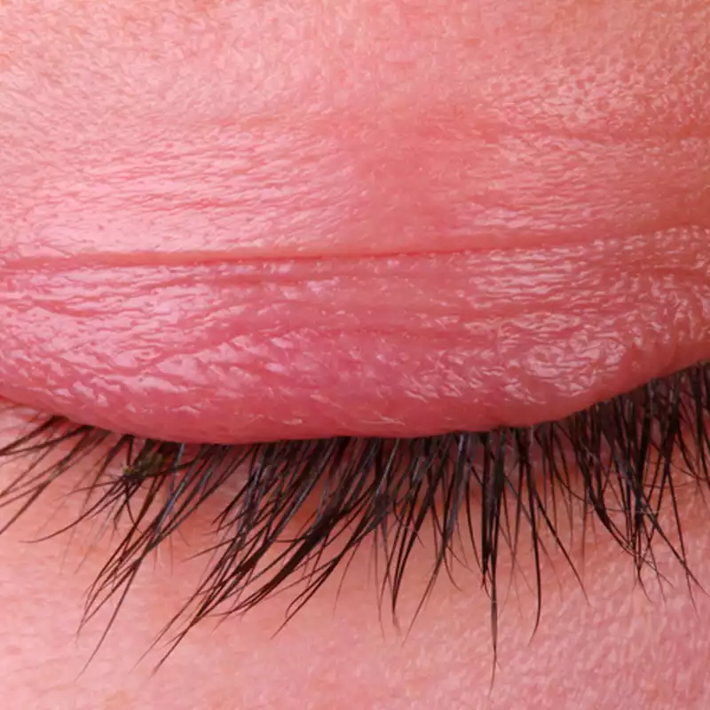 Why Are My Eyelashes Itchy How to Prevent Lash Extension Itch?